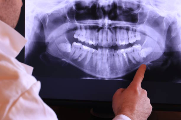 Best Urgent Tooth Repair  in North Port, FL